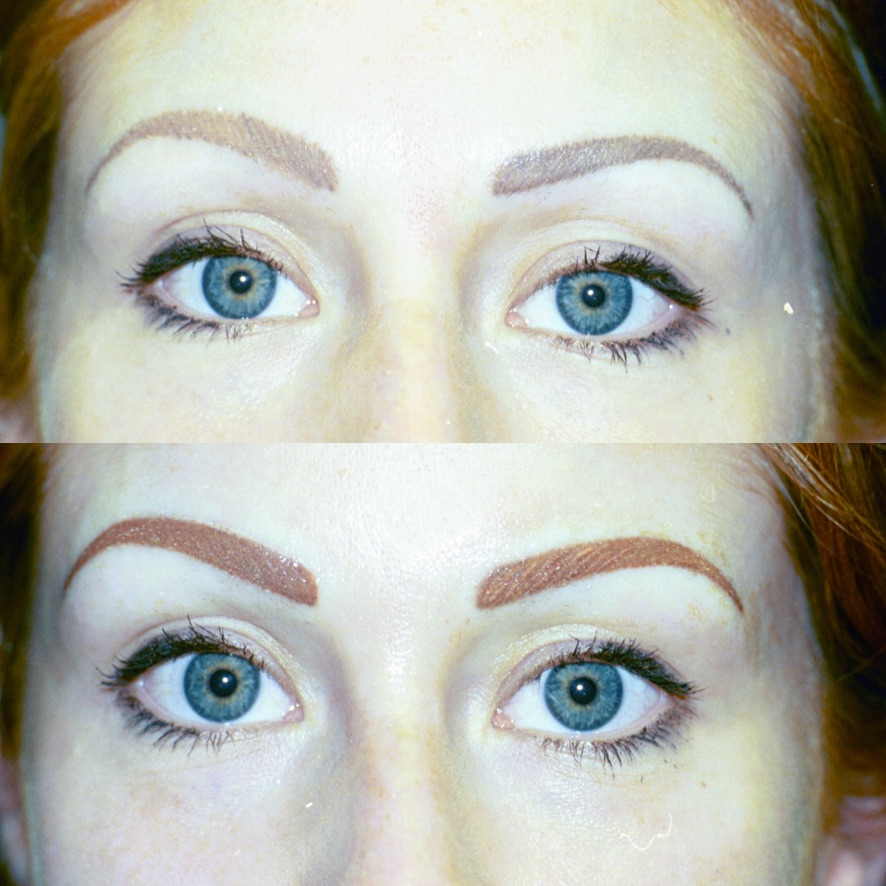 Before/After Eyebrow Correction
